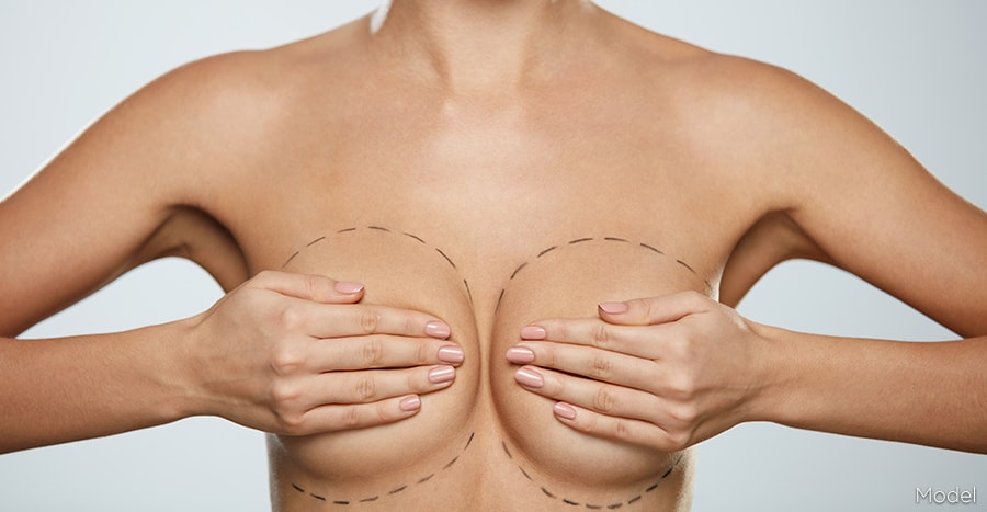 Enhance Your Confidence: Breast Augmentation in Miami